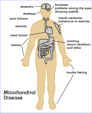 Mitochondrial Disease