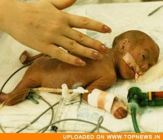 Premature Baby
