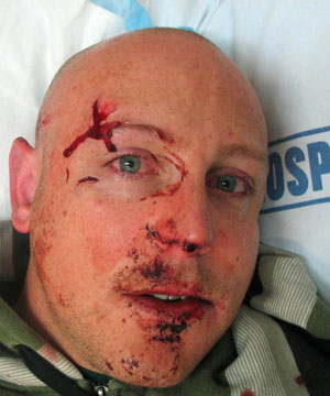 Teenaged boys attack Scottish tourist in Australia, tourist reported to be critical