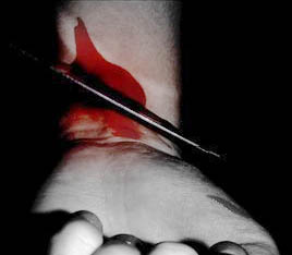 Self-harm