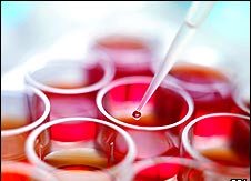 Stem cells can heal damaged bones and joints without difficult surgeries 