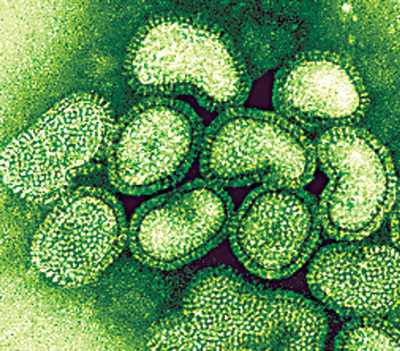Swine flu menace looms large over Nepal  