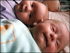 IVF twins are at greater risk of illness or early death compared to naturally conceived twins